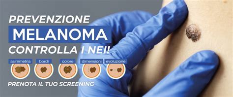 Immagine di una mappatura dei nevi digitale