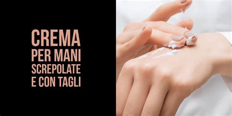 mani screpolate trattate con crema