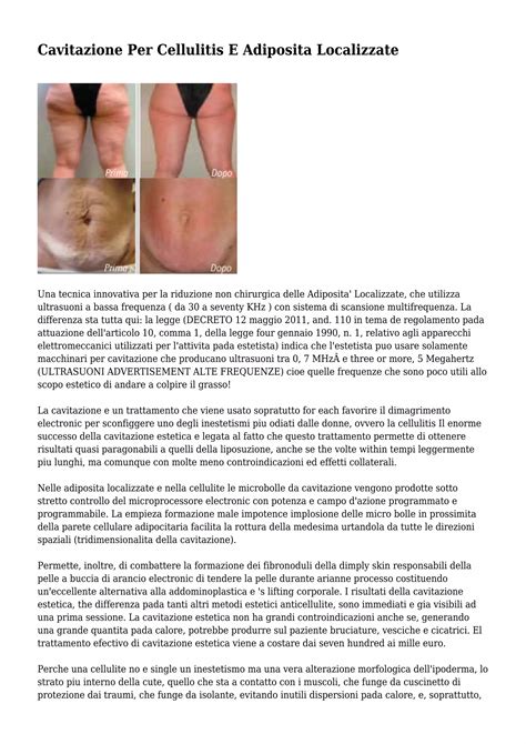 Progressione dei risultati con un trattamento anticellulite costante
