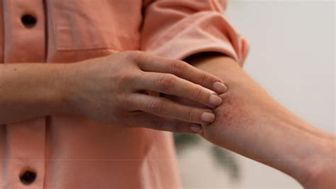 Schema che illustra i diversi tipi di micosi cutanee e le relative aree di applicazione delle formulazioni Pevaryl