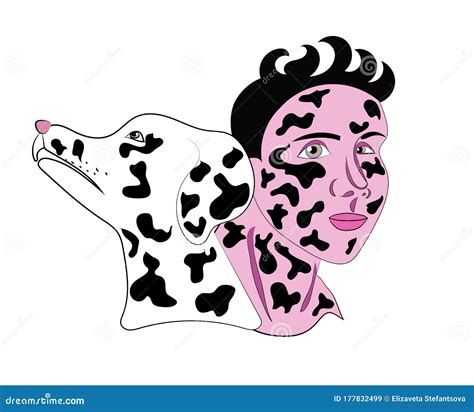 Illustrazione di una persona con chiazze di vitiligine sul viso e sulle braccia