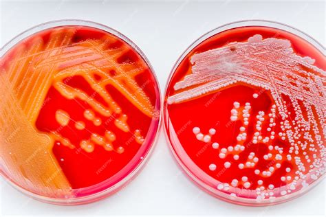 illustrazione di Staphylococcus aureus e Streptococcus pyogenes