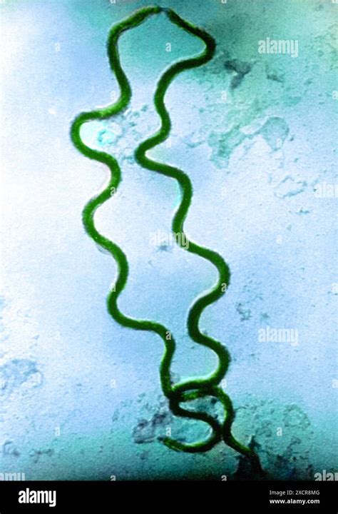 Illustrazione dei batteri Treponema spp. al microscopio