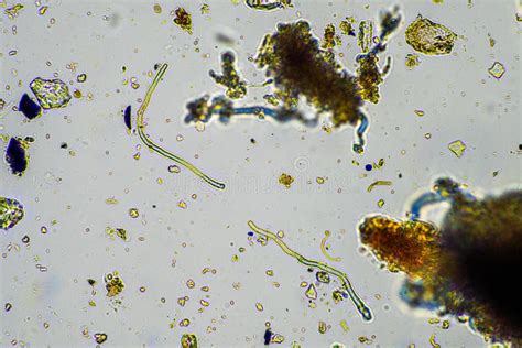 Microrganismi fungini al microscopio