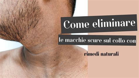 Uomo con macchie scure sul mento