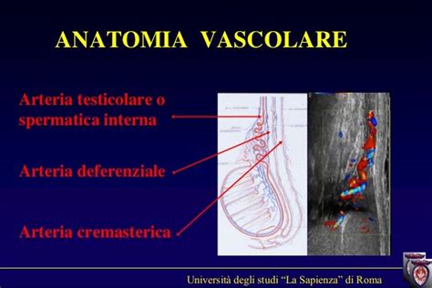 Diagramma del sistema vascolare testicolare con enfasi sul varicocele