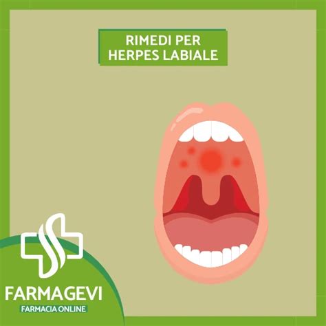 Infografica sui rimedi naturali per l'herpes labiale
