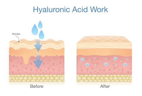 Diagramma che illustra l'azione degli oligopeptidi e dell'acido ialuronico sulla pelle