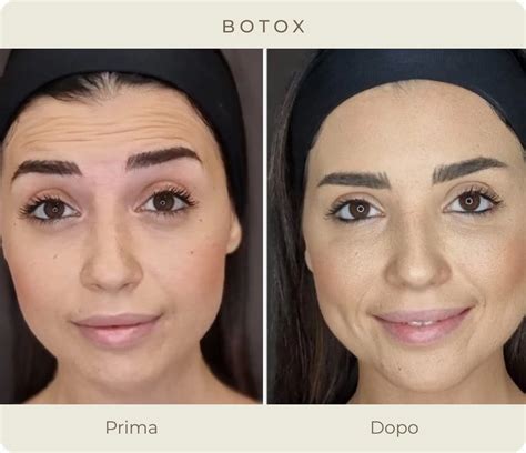 Prima e dopo: immagine che mostra la pelle del viso migliorata dall'uso della crema idratante