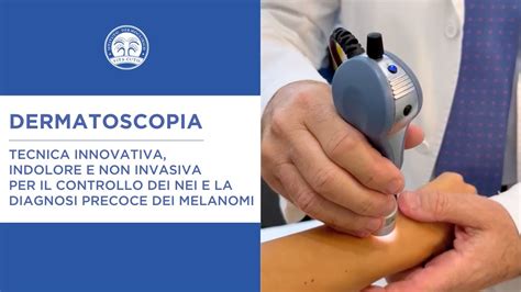 Dermatoscopio utilizzato per l'analisi dei nei