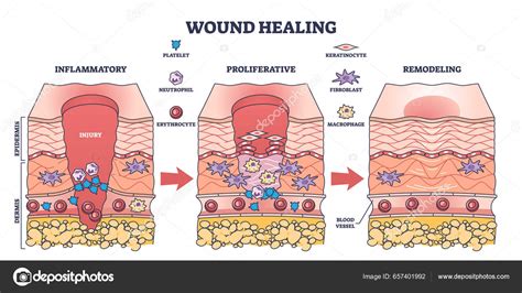 Illustrazione delle tre fasi della cicatrizzazione di una ferita