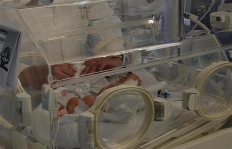 chirurgia pediatrica day surgery