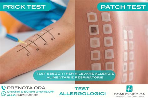 Illustrazione del Patch Test in corso su un paziente