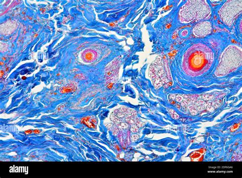 Immagine di un microscopio che osserva i follicoli piliferi