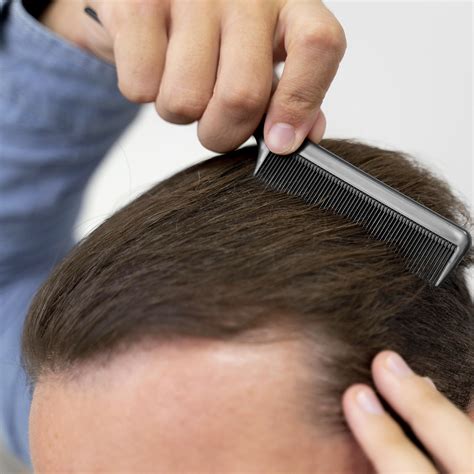 Immagine di una persona che applica una lozione sul cuoio capelluto