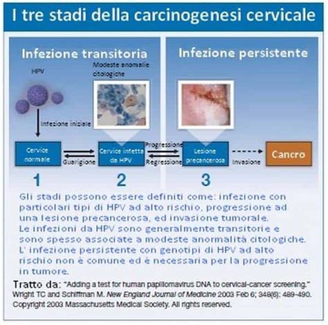 Schema di infezione da HPV con diverse tipologie di verruche