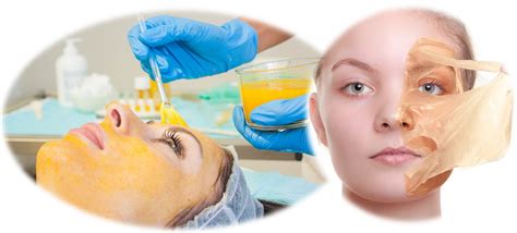 Grafico che illustra i diversi livelli di profondità dei peeling chimici