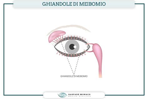 Diagramma che illustra la funzione delle ghiandole di Meibomio e l'impatto dell'isotretinoina