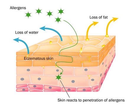 Diagramma che mostra l'effetto dell'esfoliazione sulla pelle
