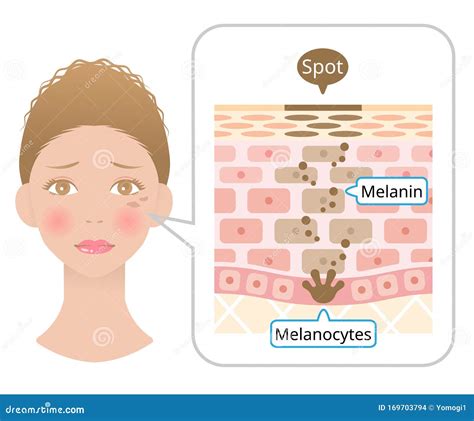 Illustrazione dei melanociti e della produzione di melanina nella pelle