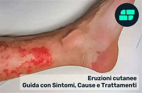 Infografica che illustra i diversi sintomi delle eruzioni cutanee