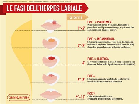 Infografica che mostra le diverse fasi di contagiosità dell'herpes