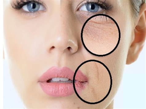 Pelle disidratata del contorno occhi