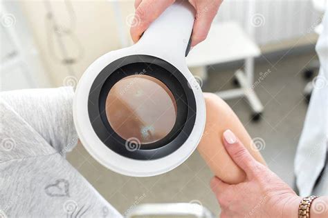 Dermatoscopio che esamina una lesione cutanea