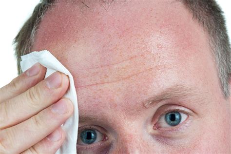 pelle irritata da sudore