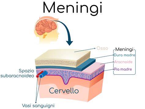 Diagramma che illustra la localizzazione delle meningi e la diffusione del melanoma meningeo