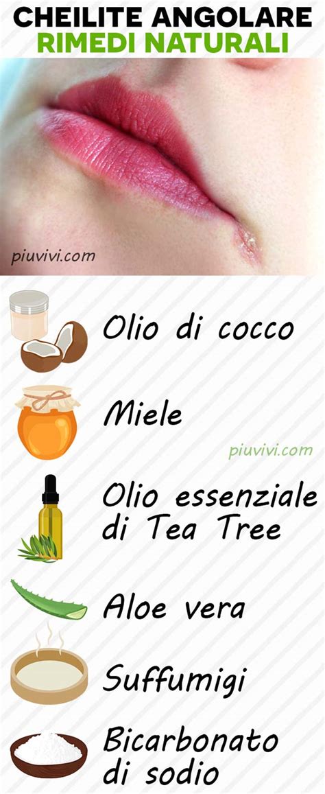 Angoli della bocca con cheilite angolare