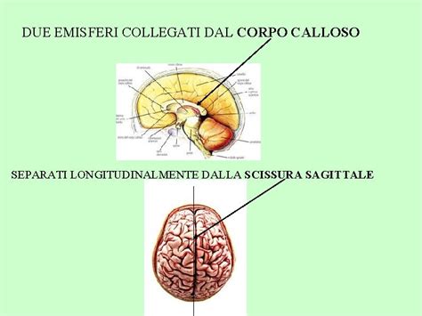 Illustrazione del corpo calloso che collega i due emisferi cerebrali