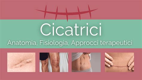 Schema delle tecniche fisioterapiche per il trattamento delle cicatrici