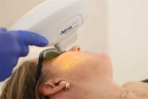 Confronto tra laser CO2 ablativo e non ablativo