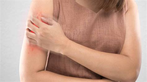 Infografica che illustra le diverse cause sistemiche di prurito