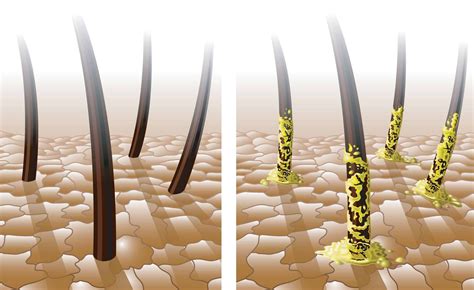 Illustrazione stilizzata di capelli sani che crescono da un cuoio capelluto stimolato