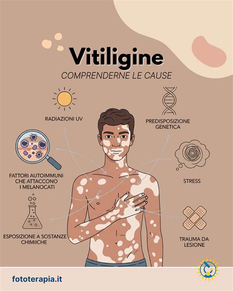 Diagramma che illustra le possibili cause autoimmuni della vitiligine