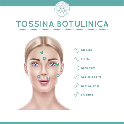 Diagramma che illustra l'azione della tossina botulinica sui muscoli facciali