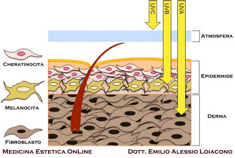 Illustrazione del danno solare sulla pelle