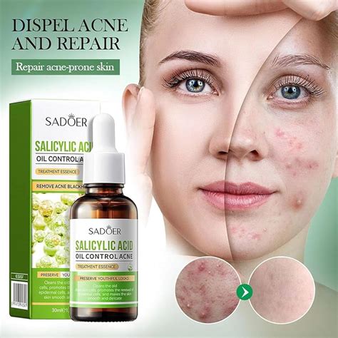 Acido Salicilico cristalli