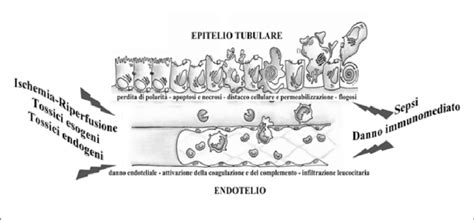 Illustrazione dell'unità pilosebacea e dei meccanismi patogenetici dell'acne