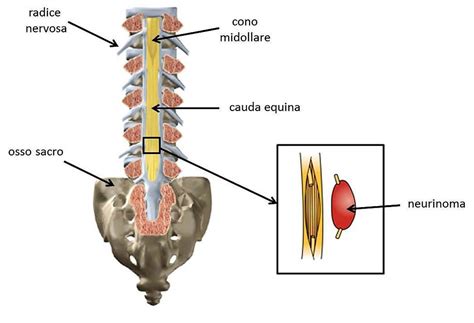 Illustrazione anatomica della cauda equina all'interno della colonna vertebrale lombare