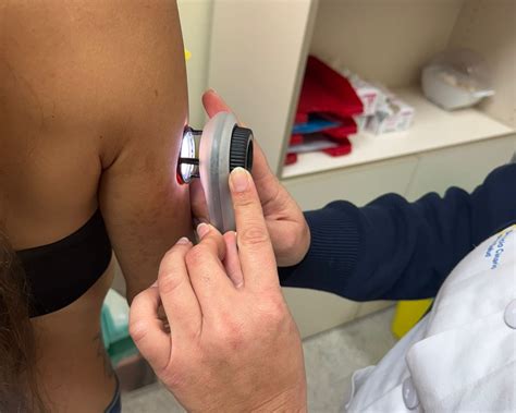 Dermatoscopio in uso