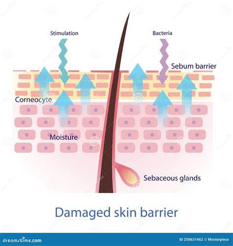 diagramma della barriera cutanea