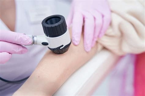 Dermatoscopio che esamina un neo