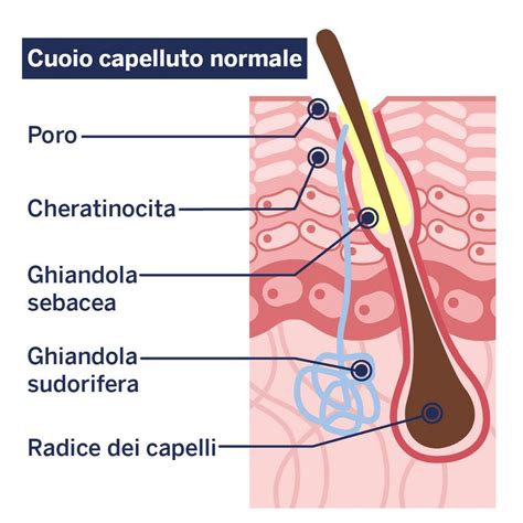 Illustrazione di un cuoio capelluto sano contrapposto a uno irritato con punti di infiammazione e desquamazione