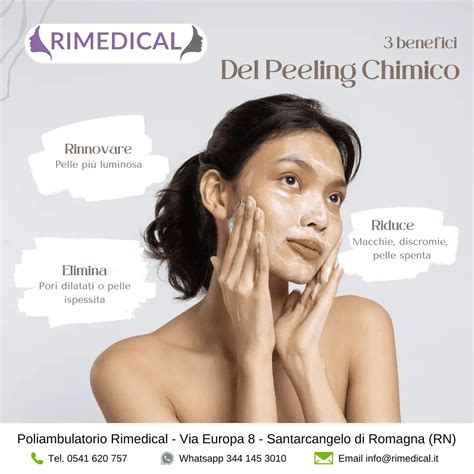 Schema del peeling chimico