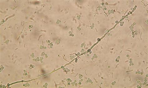 Microscopio che mostra la forma a lievito e a ifa della Candida
