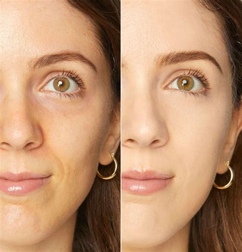 Applicazione fondotinta correttore su una cicatrice