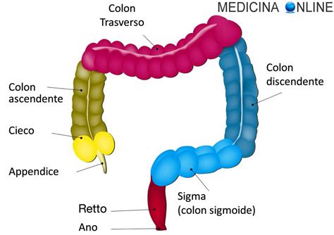 Diagramma del colon che mostra la posizione di un polipo